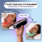 💤Smart Snoring Prevention Device