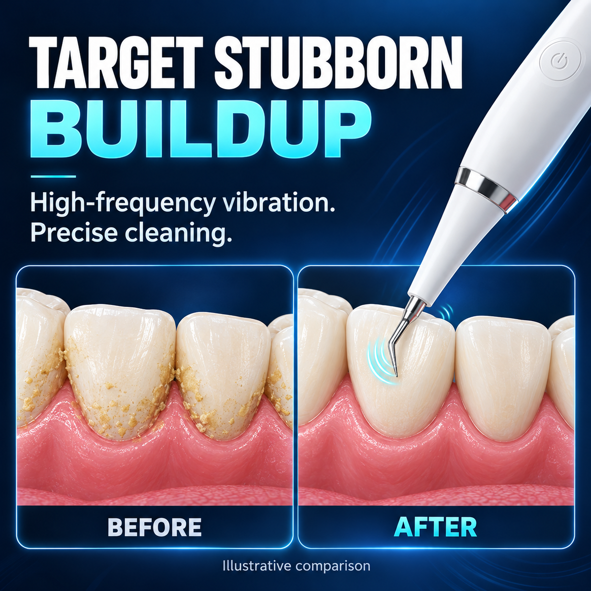 🦷 The Ultimate Sonic Clean Routine Set | 5-Mode Oral Care System 🚀